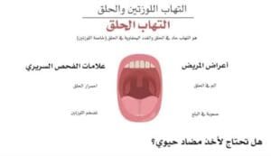 علاج احتقان الزور بالاعشاب