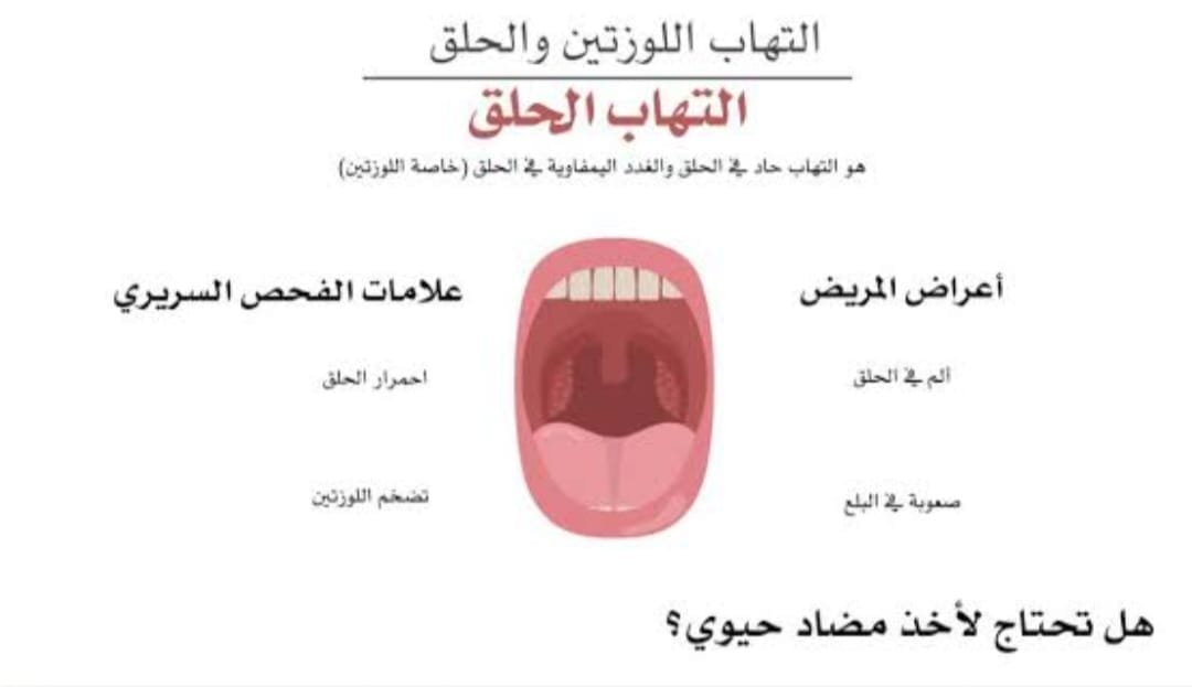 علاج احتقان الزور بالاعشاب