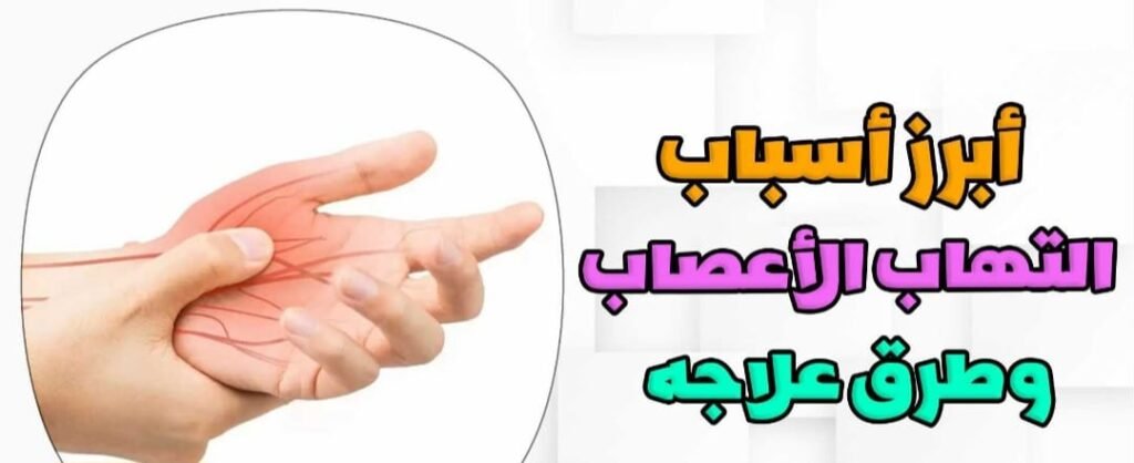 علاج التهاب الاعصاب