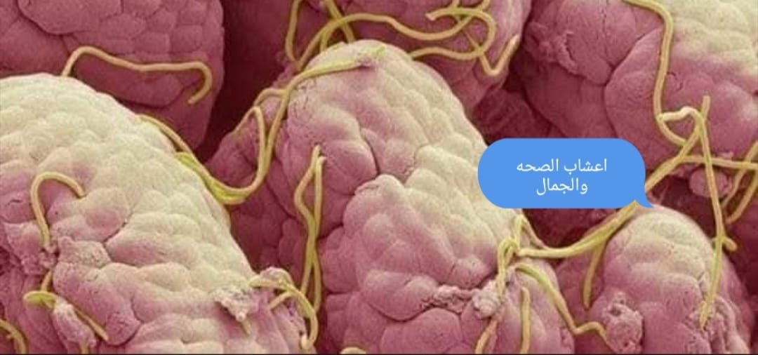 علاج الديدان الدبوسية